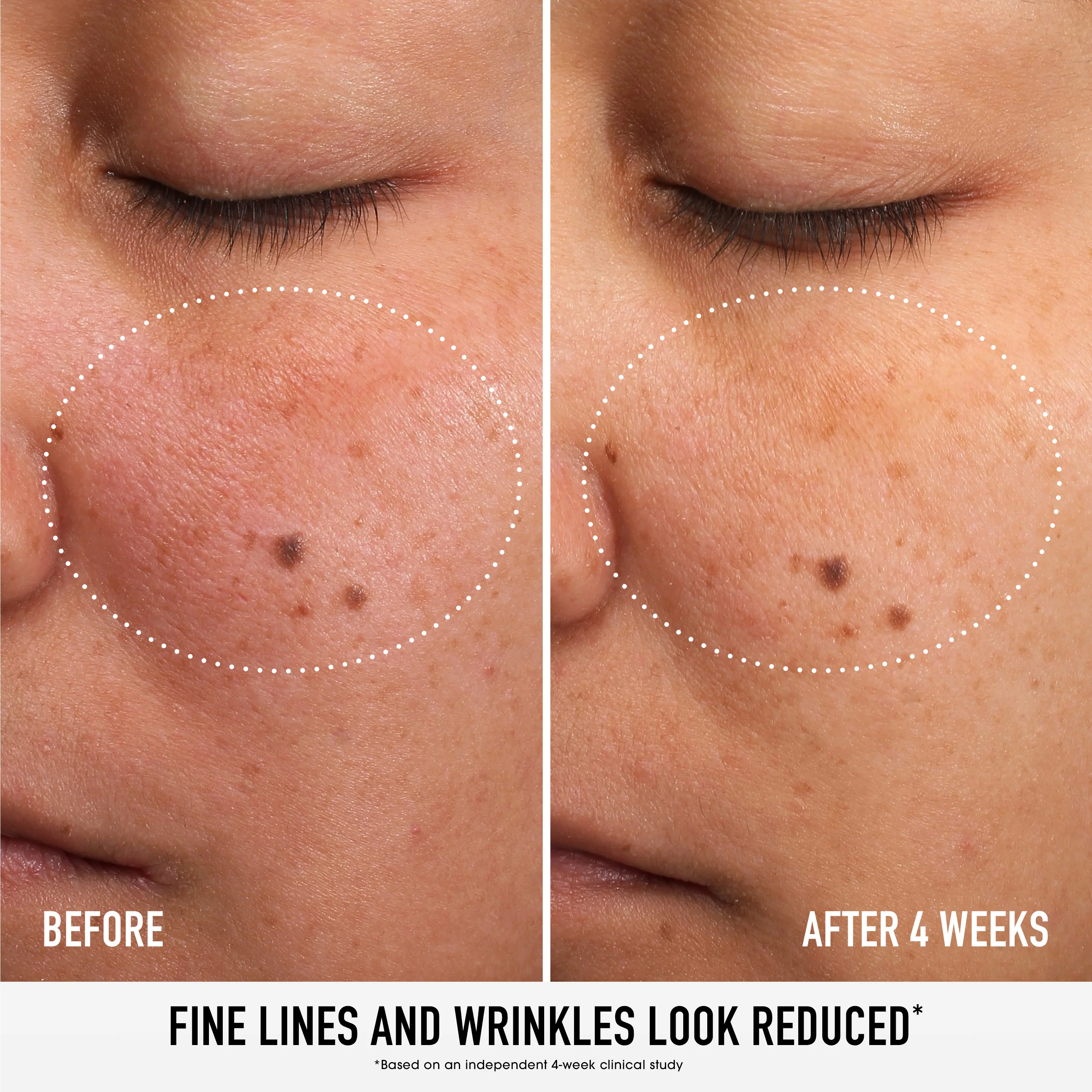 SKIN RESCUE Pure Smooth Serum with 5% Niacinamide and Chebula - Image 3